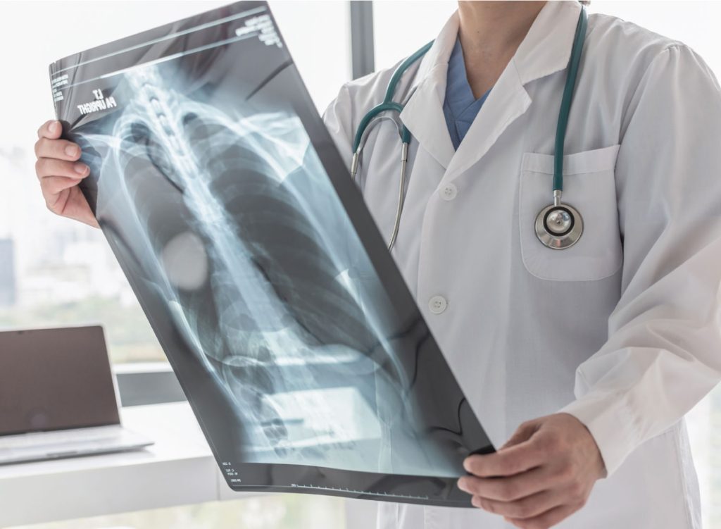 X-Ray